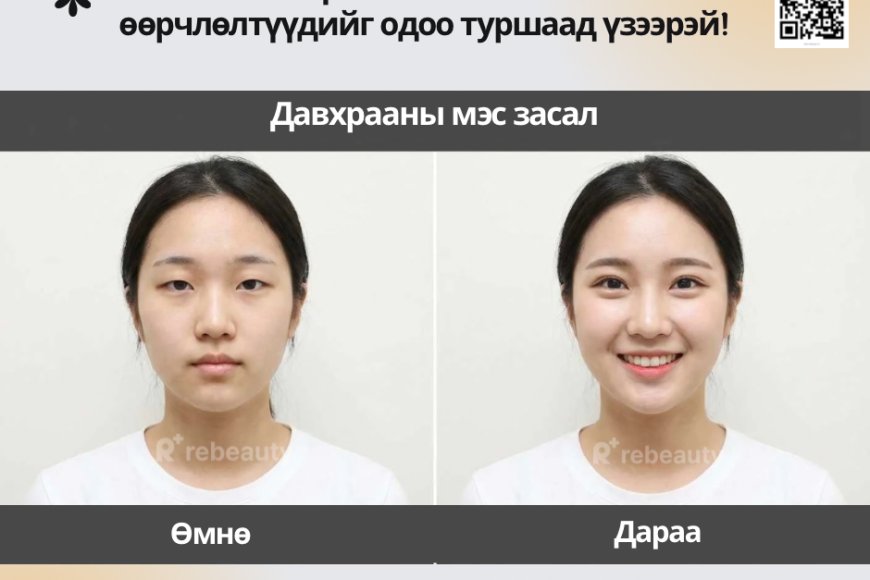 💎 Солонгосын гоо сайхны мэс заслын эмнэлгийн бүх мэдээлэл энд!
